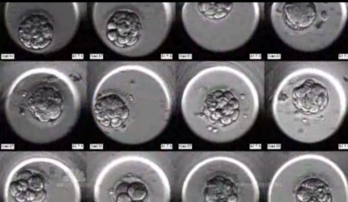 Эмбриоскоп. Культивирование в эмбриоскопе. Развитие эмбриона в эмбриоскопе. Эмбриоскоп фото.